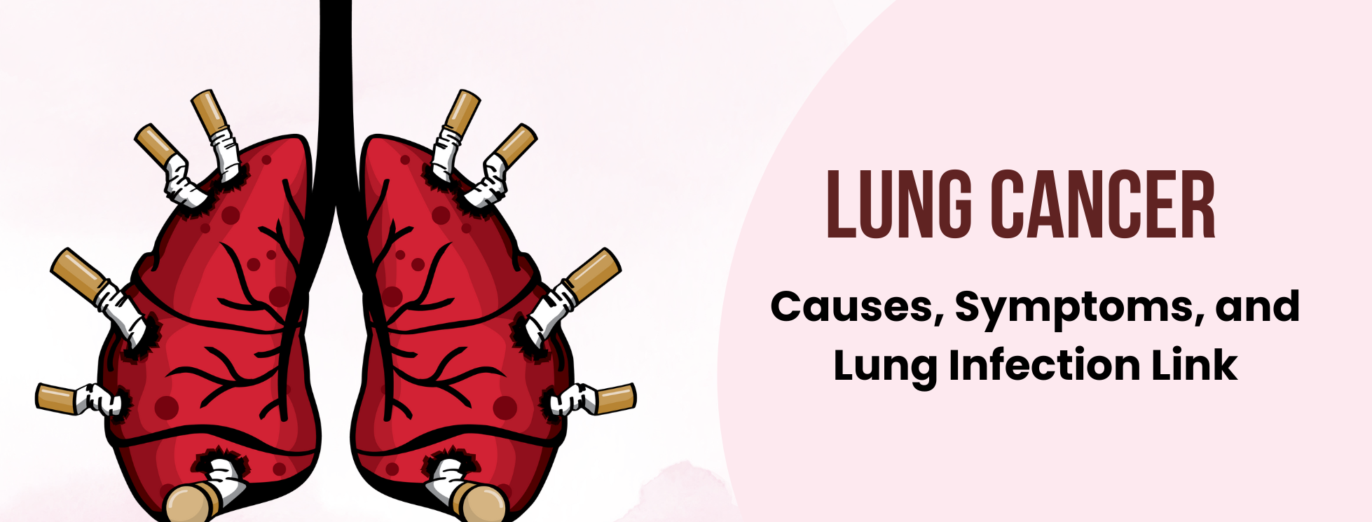 Lung Cancer